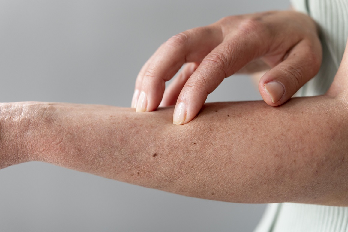 Dermatose Ocupacional: causas, prevenção e tratamento
